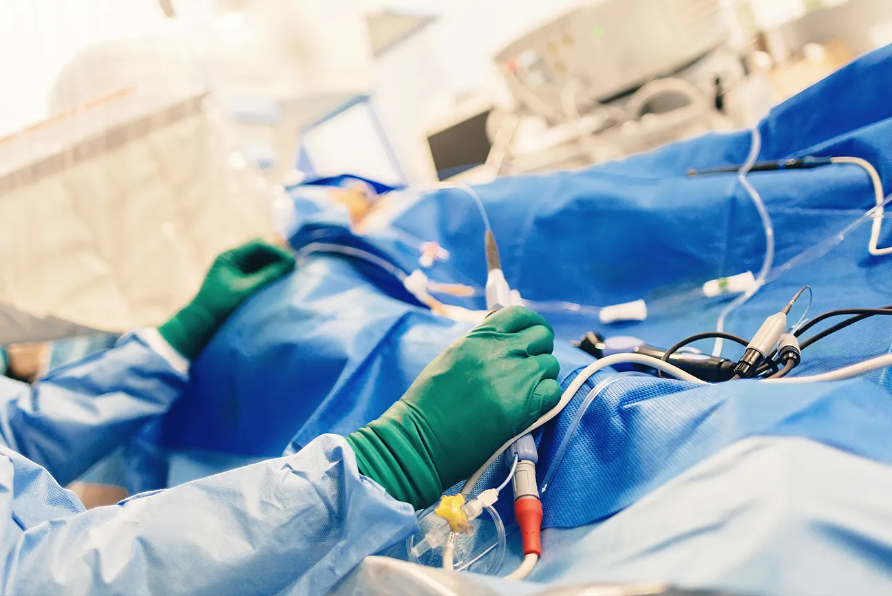 Ablation de fibrillation atriale