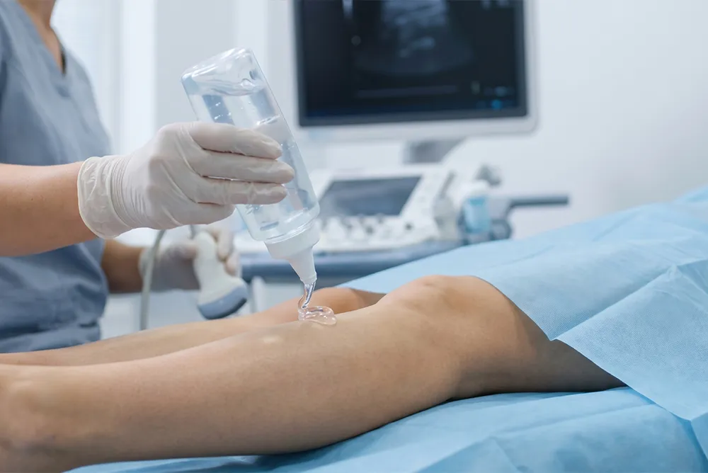 &Eacute;cho-Doppler vasculaire d&rsquo;un membre inf&eacute;rieur pour &eacute;valuer la circulation sanguine art&eacute;rielle et veineuse