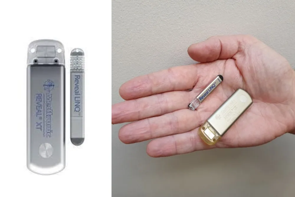 Holter cardiaque implantable miniaturis&eacute; utilis&eacute; pour la surveillance prolong&eacute;e du rythme cardiaque