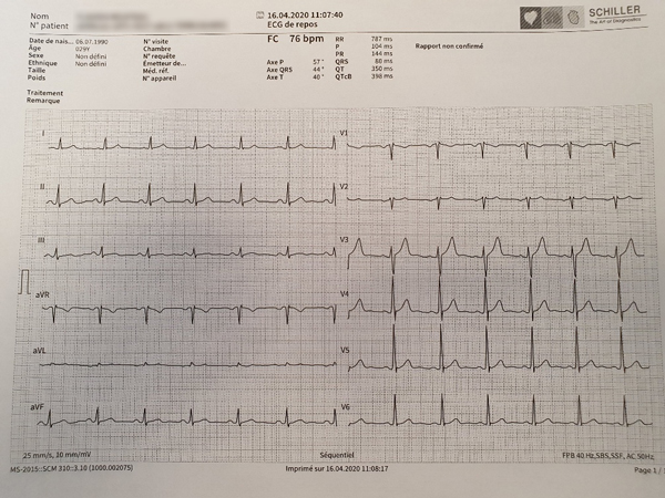 Résultats ECG